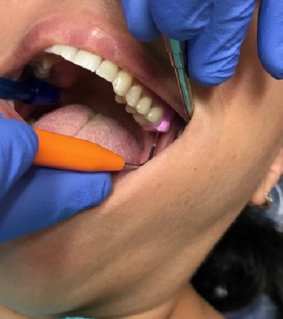 Periodontal Figure6 Periodontal Figure6
